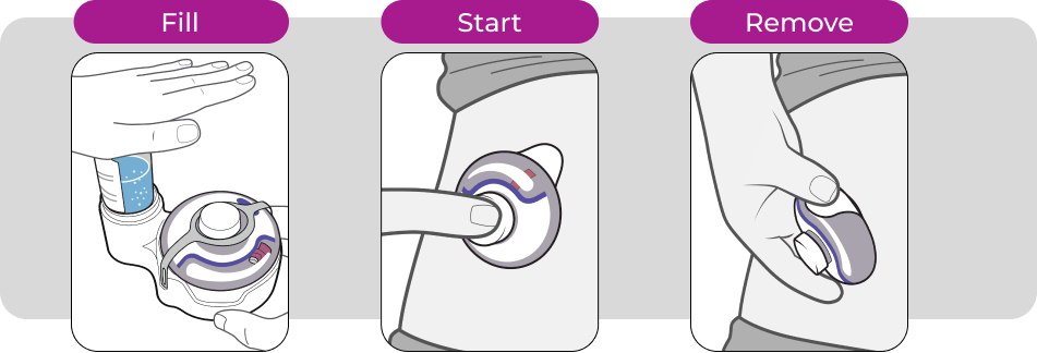 Technology Easytousegraphic-threesteps Enable Injections